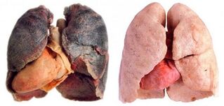 Πνεύμονες καπνιστές και υγιείς